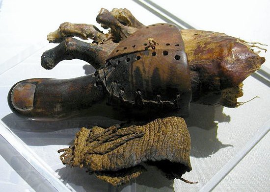15. Самый старый протез (3000 лет) история, самые первые, факты