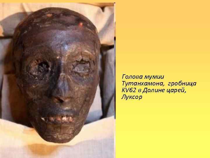Голова мумии Тутанхамона, гробница KV 62 в Долине царей, Луксор 