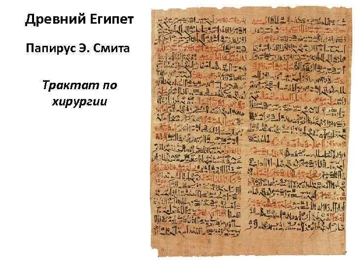 Древний Египет Папирус Э. Смита Трактат по хирургии 