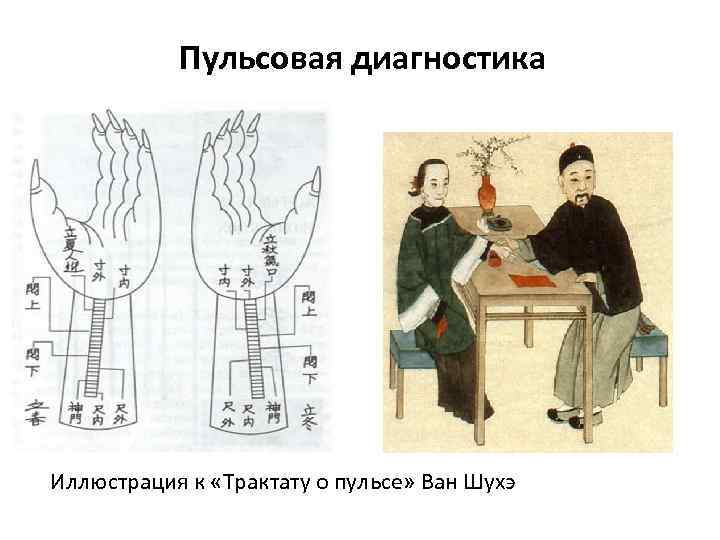 Пульсовая диагностика Иллюстрация к «Трактату о пульсе» Ван Шухэ 