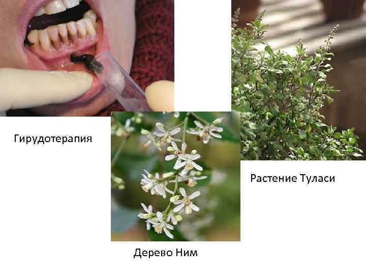 Гирудотерапия Растение Туласи Дерево Ним 